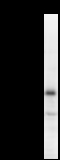 MED26 / CRSP7 Antibody - Detection of human CRSP7 by Western blot. Samples: Whole cell lysate (25 ug) from HEK293 cells. Predicted molecular weight: 65 kDa