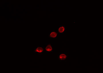 MED26 / CRSP7 Antibody - Staining LOVO cells by IF/ICC. The samples were fixed with PFA and permeabilized in 0.1% Triton X-100, then blocked in 10% serum for 45 min at 25°C. The primary antibody was diluted at 1:200 and incubated with the sample for 1 hour at 37°C. An Alexa Fluor 594 conjugated goat anti-rabbit IgG (H+L) antibody, diluted at 1/600, was used as secondary antibody.