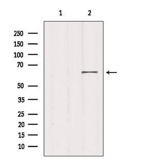 MED26 / CRSP7 Antibody - Western blot analysis of extracts of 293 cells using MED26 antibody. Lane 1 was treated with the blocking peptide.
