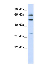 MED26 / CRSP7 Antibody - MED26 / CRSP7 antibody Western blot of 293T cell lysate. This image was taken for the unconjugated form of this product. Other forms have not been tested.