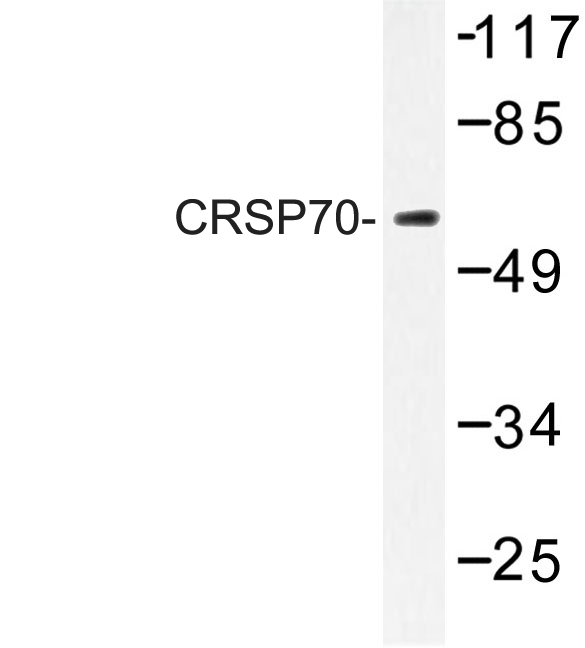 MED26 / CRSP7 Antibody - Western blot of CRSP70 (S7) pAb in extracts from LOVO cells.
