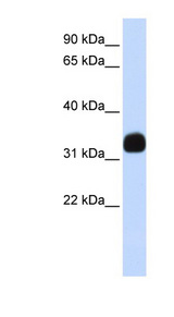 MED27 / CRSP8 Antibody - MED27 / CRSP8 antibody Western blot of Fetal Brain lysate. This image was taken for the unconjugated form of this product. Other forms have not been tested.