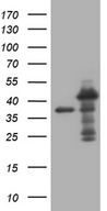 MED27 / CRSP8 Antibody - HEK293T cells were transfected with the pCMV6-ENTRY control. (Left lane) or pCMV6-ENTRY MED27. (Right lane) cDNA for 48 hrs and lysed. Equivalent amounts of cell lysates. (5 ug per lane) were separated by SDS-PAGE and immunoblotted with anti-MED27. (1:2000)