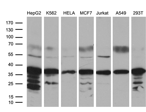MED27 / CRSP8 Antibody - Western blot analysis of extracts. (35ug) from 7 different cell lines by using anti-MED27 monoclonal antibody. (1:500)