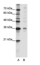 MED27 / CRSP8 Antibody - A: Marker, B: HepG2 Cell Lysate.  This image was taken for the unconjugated form of this product. Other forms have not been tested.