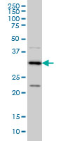 MED27 / CRSP8 Antibody - CRSP8 monoclonal antibody (M01), clone 8B8 Western blot of CRSP8 expression in HeLa NE.