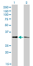 MED27 / CRSP8 Antibody - Western blot of CRSP8 expression in transfected 293T cell line by CRSP8 monoclonal antibody (M01), clone 8B8.