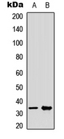 MED27 / CRSP8 Antibody - Western blot analysis of CRSP8 expression in Jurkat (A); HeLa (B) whole cell lysates.