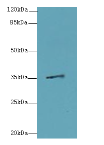 MED27 / CRSP8 Antibody - Western blot. All lanes: MED27 antibody at 0.5 ug/ml+A40- whole cell lysate Goat polyclonal to rabbit at 1:10000 dilution. Predicted band size: 35 kDa. Observed band size: 35 kDa.