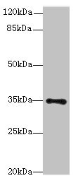 MED27 / CRSP8 Antibody - Western blot All lanes: MED27 antibody at 0.5µg/ml + A431 whole cell lysate Secondary Goat polyclonal to rabbit IgG at 1/10000 dilution Predicted band size: 36, 32, 15 kDa Observed band size: 36 kDa