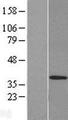 MED27 / CRSP8 Protein - Western validation with an anti-DDK antibody * L: Control HEK293 lysate R: Over-expression lysate