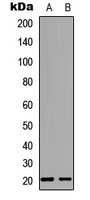 MED28 / Magicin Antibody - Western blot analysis of MED28 expression in Raw264.7 (A); PC12 (B) whole cell lysates.