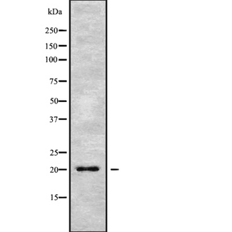 MED28 / Magicin Antibody - Western blot analysis of MED28 using MCF-7 whole cells lysates