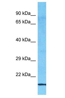 MED30 Antibody - MED30 antibody Western Blot of ACHN. Antibody dilution: 1 ug/ml.  This image was taken for the unconjugated form of this product. Other forms have not been tested.