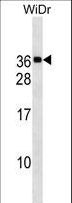 MED30 Antibody - MED30 Antibody western blot of WiDr cell line lysates (35 ug/lane). The MED30 antibody detected the MED30 protein (arrow).