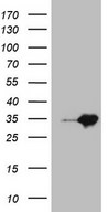 MED30 Antibody - HEK293T cells were transfected with the pCMV6-ENTRY control. (Left lane) or pCMV6-ENTRY MED30. (Right lane) cDNA for 48 hrs and lysed. Equivalent amounts of cell lysates. (5 ug per lane) were separated by SDS-PAGE and immunoblotted with anti-MED30. (1:2000)