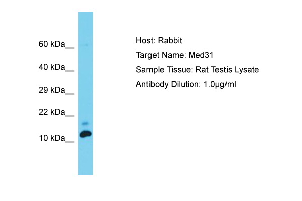 MED31 Antibody -  This image was taken for the unconjugated form of this product. Other forms have not been tested.