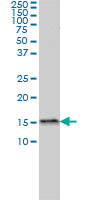 MED31 Antibody - MED31 monoclonal antibody (M01), clone 2C8 Western blot of MED31 expression in MCF-7.