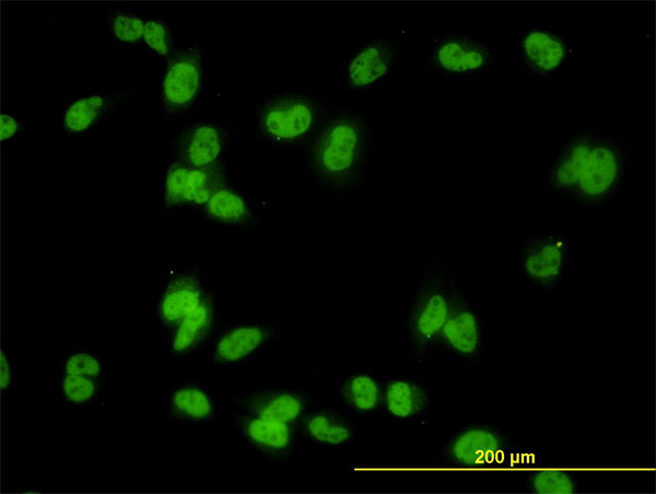 MED31 Antibody - Immunofluorescence of monoclonal antibody to MED31 on HeLa cell. [antibody concentration 10 ug/ml]