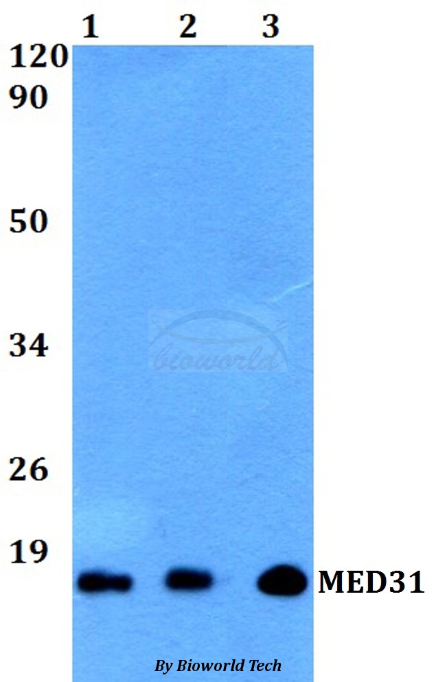 MED31 Antibody - Western blot of MED31 antibody at 1:500 dilution. Lane 1: HeLa whole cell lysate. Lane 2: sp2/0 whole cell lysate. Lane 3: MCF-7 whole cell lysate.