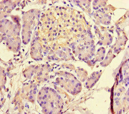 MED31 Antibody - Immunohistochemistry of paraffin-embedded human pancreatic tissue at dilution of 1:100