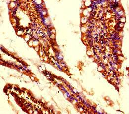 MED31 Antibody - Immunohistochemistry of paraffin-embedded human small intestine tissue at dilution of 1:100