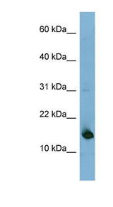 MED31 Antibody - MED31 antibody Western blot of Fetal Liver lysate. This image was taken for the unconjugated form of this product. Other forms have not been tested.