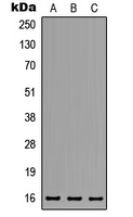 MED31 Antibody - Western blot analysis of MED31 expression in HeLa (A); MCF7 (B); NS-1 (C) whole cell lysates.