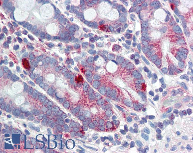 MED4 Antibody - Anti-MED4 antibody IHC of human small intestine. Immunohistochemistry of formalin-fixed, paraffin-embedded tissue after heat-induced antigen retrieval. Antibody concentration 5 ug/ml.  This image was taken for the unconjugated form of this product. Other forms have not been tested.