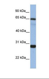 MED4 Antibody - Fetal liver lysate. Antibody concentration: 1.0 ug/ml. Gel concentration: 12%.  This image was taken for the unconjugated form of this product. Other forms have not been tested.