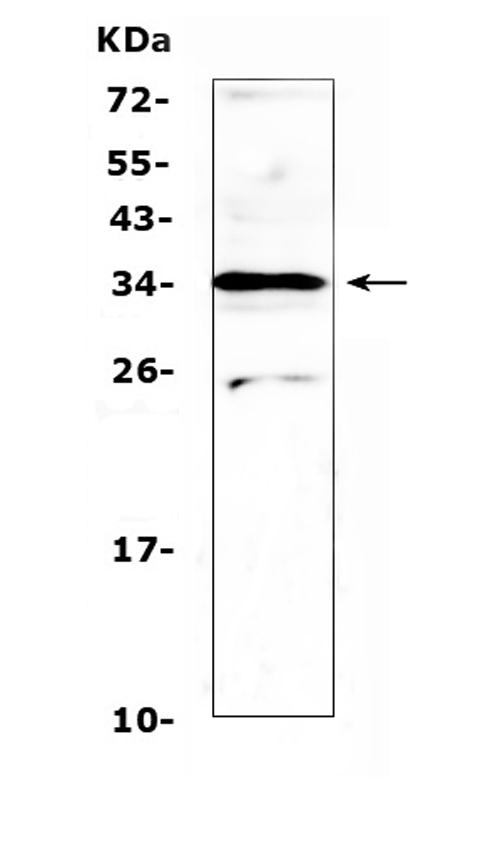 MED4 Antibody - Western blot analysis of MED4 using anti-MED4 antibody. Electrophoresis was performed on a 5-20% SDS-PAGE gel at 70V (Stacking gel) / 90V (Resolving gel) for 2-3 hours. The sample well of each lane was loaded with 50ug of sample under reducing conditions. Lane 1: rat spleen tissue lysates. After Electrophoresis, proteins were transferred to a Nitrocellulose membrane at 150mA for 50-90 minutes. Blocked the membrane with 5% Non-fat Milk/ TBS for 1.5 hour at RT. The membrane was incubated with rabbit anti-MED4 antigen affinity purified polyclonal antibody at 0.5 ug/mL overnight at 4?, then washed with TBS-0.1% Tween 3 times with 5 minutes each and probed with a goat anti-rabbit IgG-HRP secondary antibody at a dilution of 1:10000 for 1.5 hour at RT. The signal is developed using an Enhanced Chemiluminescent detection (ECL) kit with Tanon 5200 system. A specific band was detected for MED4 at approximately 34KD. The expected band size for MED4 is at 30KD.
