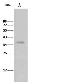 MED4 Antibody - Anti-MED4 rabbit polyclonal antibody at 1:500 dilution. Lane A: A549 Whole Cell Lysate. Lysates/proteins at 30 ug per lane. Secondary: Goat Anti-Rabbit IgG (H+L)/HRP at 1/10000 dilution. Developed using the ECL technique. Performed under reducing conditions. Predicted band size: 30 kDa. Observed band size: 35 kDa.