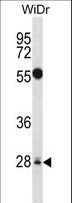 MED6 Antibody - MED6 Antibody western blot of WiDr cell line lysates (35 ug/lane). The MED6 antibody detected the MED6 protein (arrow).