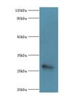 MED6 Antibody - Western blot. All lanes: MED6 antibody at 8 ug/ml+Jurkat whole cell lysate. Secondary antibody: Goat polyclonal to rabbit at 1:10000 dilution. Predicted band size: 28 kDa. Observed band size: 28 kDa.