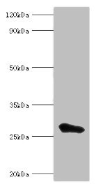 MED6 Antibody - Western blot All lanes: MED6 antibody at 8µg/ml + Jurkat whole cell lysate Secondary Goat polyclonal to rabbit IgG at 1/10000 dilution Predicted band size: 29, 30, 21 kDa Observed band size: 29 kDa