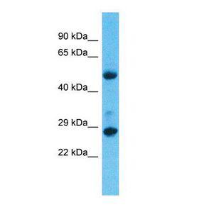MED6 Antibody - Western blot of Human Lung Tumor. MED6 antibody dilution 1.0 ug/ml.  This image was taken for the unconjugated form of this product. Other forms have not been tested.