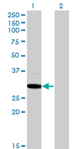MED6 Antibody - Western blot of MED6 expression in transfected 293T cell line by MED6 monoclonal antibody (M07), clone 4C2.