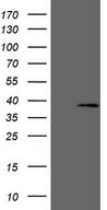 MED6 Antibody - HEK293T cells were transfected with the pCMV6-ENTRY control. (Left lane) or pCMV6-ENTRY MED6. (Right lane) cDNA for 48 hrs and lysed. Equivalent amounts of cell lysates. (5 ug per lane) were separated by SDS-PAGE and immunoblotted with anti-MED6. (1:2000)