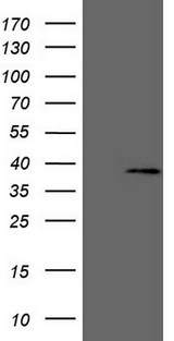 MED6 Antibody - HEK293T cells were transfected with the pCMV6-ENTRY control. (Left lane) or pCMV6-ENTRY MED6. (Right lane) cDNA for 48 hrs and lysed