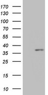 MED6 Antibody - HEK293T cells were transfected with the pCMV6-ENTRY control. (Left lane) or pCMV6-ENTRY MED6. (Right lane) cDNA for 48 hrs and lysed. Equivalent amounts of cell lysates. (5 ug per lane) were separated by SDS-PAGE and immunoblotted with anti-MED6. (1:2000)
