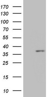 MED6 Antibody - HEK293T cells were transfected with the pCMV6-ENTRY control. (Left lane) or pCMV6-ENTRY MED6. (Right lane) cDNA for 48 hrs and lysed