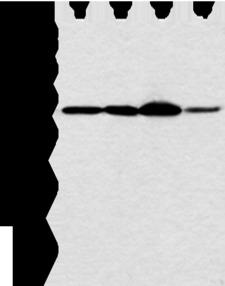 MED6 Antibody - Western blot analysis of Hela and PC3 cell 231 cell and human esophagus cancer tissue  using MED6 Polyclonal Antibody at dilution of 1:400