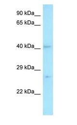 MED7 / CRSP9 Antibody - MED7 / CRSP9 antibody Western Blot of Fetal Thymus.  This image was taken for the unconjugated form of this product. Other forms have not been tested.