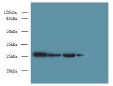 MED7 / CRSP9 Antibody - Western blot. All lanes: MED7 antibody at 6 ug/ml. Lane 1: Jurkat whole cell lysate. Lane 2: HeLa whole cell lysate. Lane 3: Mouse thymus tissue. Lane 4: NIH/3T3 whole cell lysate. Secondary antibody: Goat polyclonal to Rabbit IgG at 1:10000 dilution. Predicted band size: 27 kDa. Observed band size: 27 kDa.