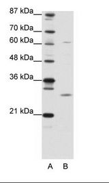 MED7 / CRSP9 Antibody - A: Marker, B: 293T Cell Lysate.  This image was taken for the unconjugated form of this product. Other forms have not been tested.