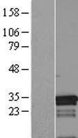 MED7 / CRSP9 Protein - Western validation with an anti-DDK antibody * L: Control HEK293 lysate R: Over-expression lysate