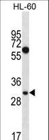 MED8 Antibody - MED8 Antibody western blot of HL-60 cell line lysates (35 ug/lane). The MED8 antibody detected the MED8 protein (arrow).