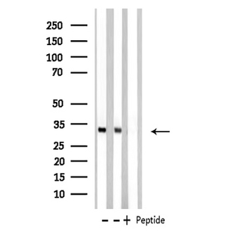 MED8 Antibody - Western blot analysis of extracts of Jurkat/K562 cells using MED8 antibody.