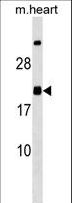 MED9 Antibody - MED9 Antibody western blot of mouse heart tissue lysates (35 ug/lane). The MED9 Antibody detected the MED9 protein (arrow).