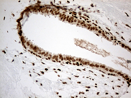 MED9 Antibody - Immunohistochemical staining of paraffin-embedded Human breast tissue within the normal limits using anti-MED9 mouse monoclonal antibody. (Heat-induced epitope retrieval by 1mM EDTA in 10mM Tris buffer. (pH8.5) at 120°C for 3 min. (1:1000)